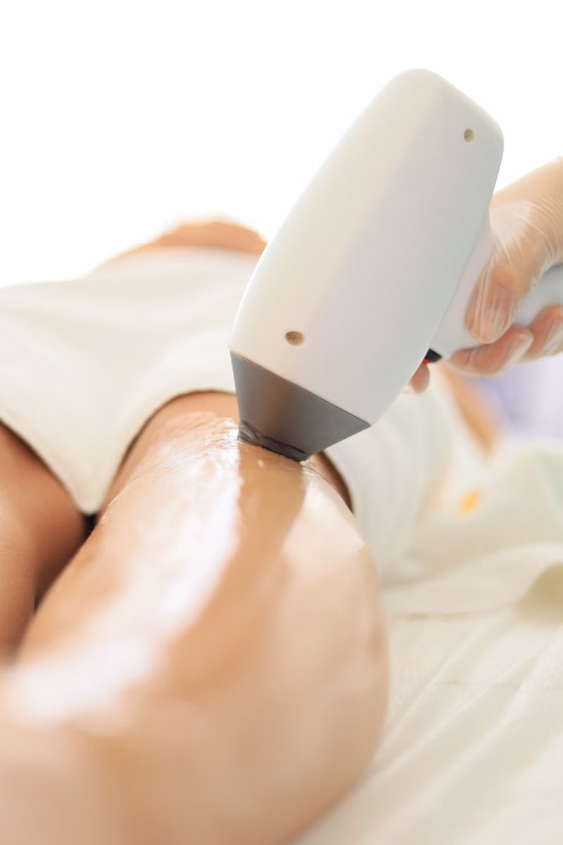 Laser hair removal in Multan - Elixir Aesthetics