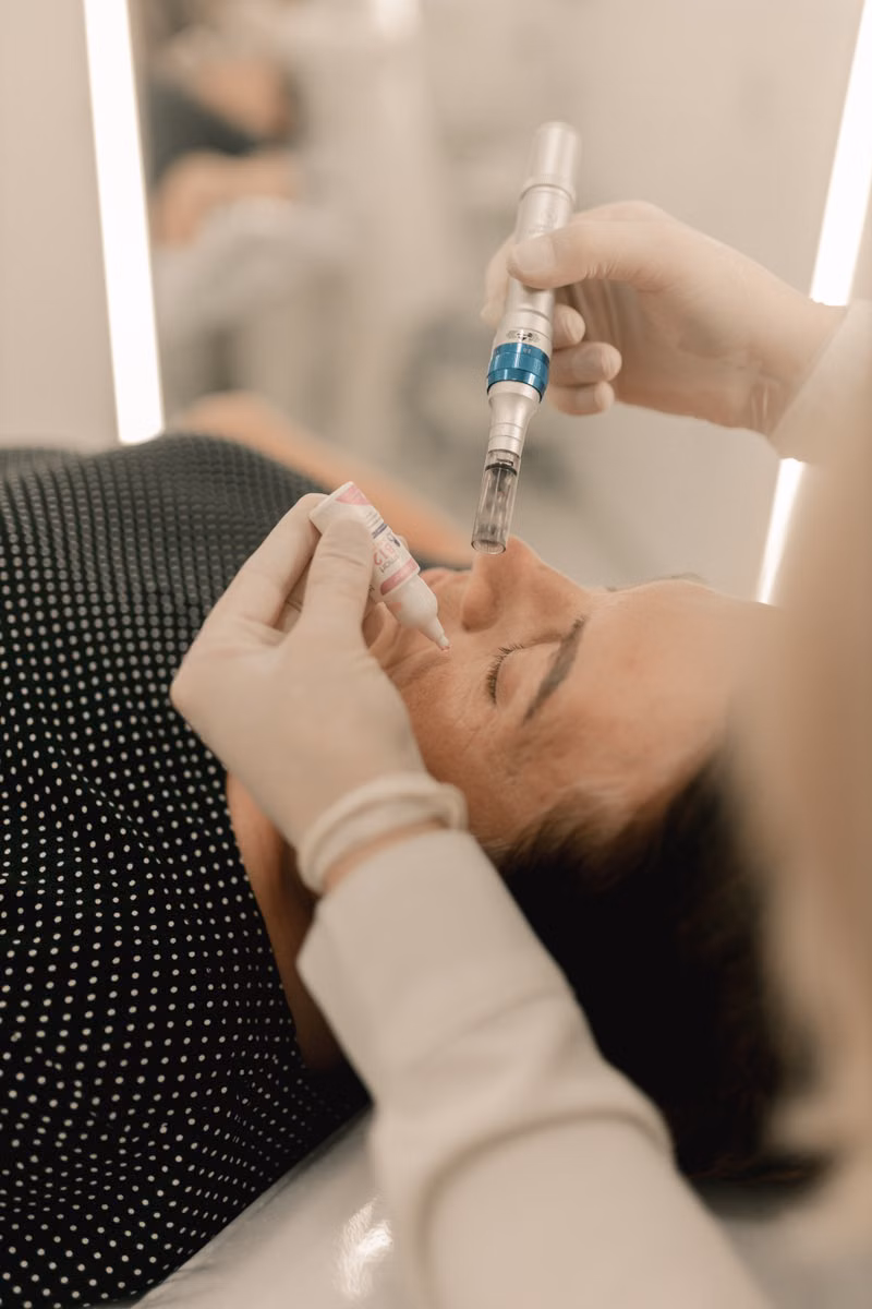PRP PRGF and Microneedling treatment in Model Town Multan - Elixir Aesthetics
