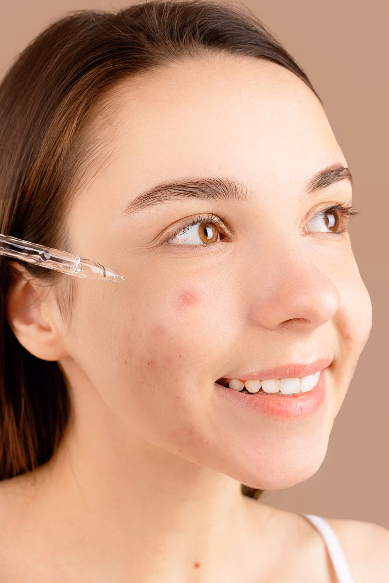 Mesotherapy and acne scar treatment in Model Town Multan - Elixir Aesthetics